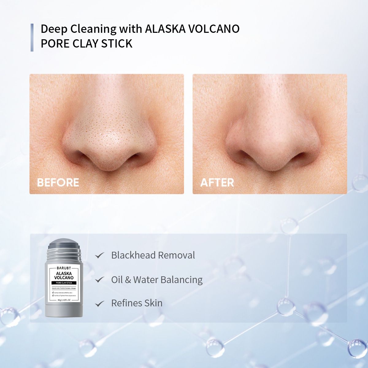 Deep Pore Cleansing Blackhead Remover