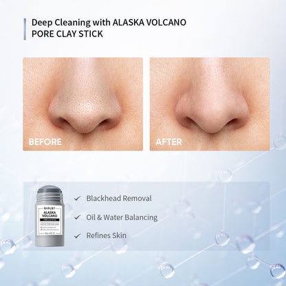 Deep Pore Cleansing Blackhead Remover