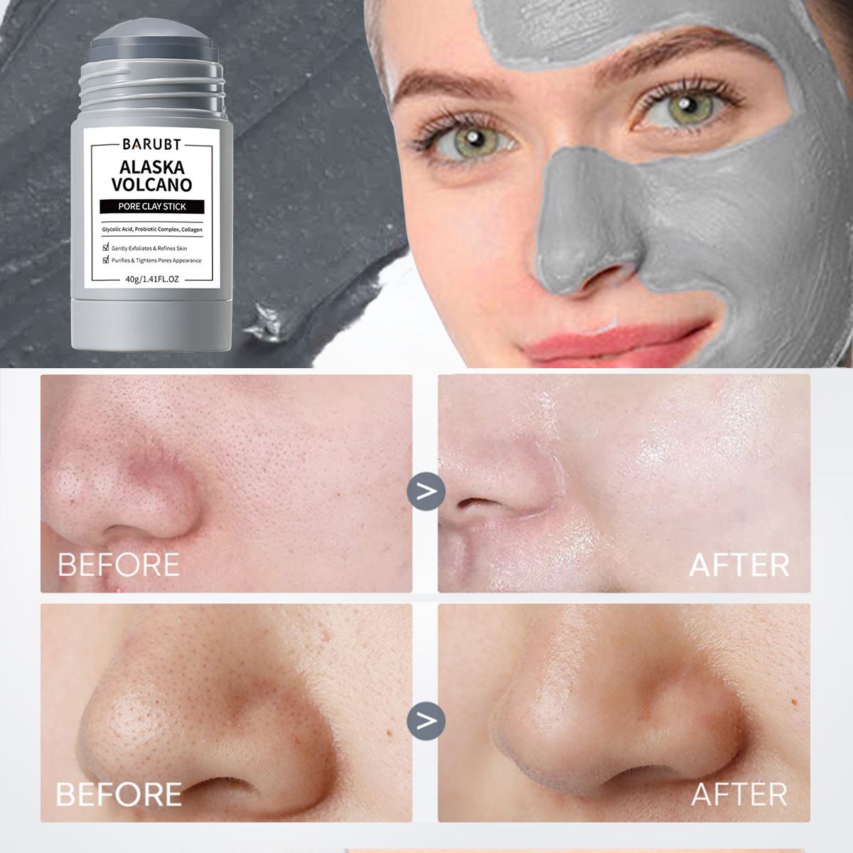 Deep Pore Cleansing Blackhead Remover