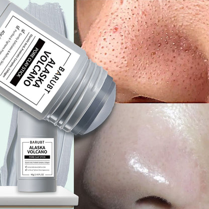 Deep Pore Cleansing Blackhead Remover
